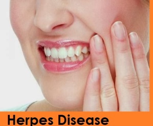 Herpes Disease